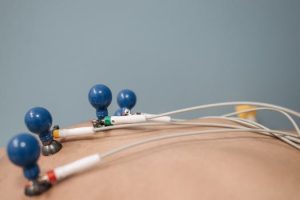 Wearable ECG and Blood Oxygen Monitors: Health on Your Wrist